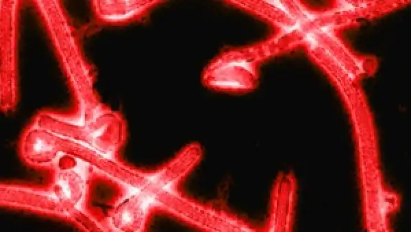 Ebola-sickened travellers may cross borders, WHO warns